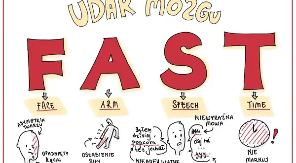 FAST - objawy udaru mózgu: opadnięta twarz, osłabienie ręki, niewyraźna mowa, brak czasu.